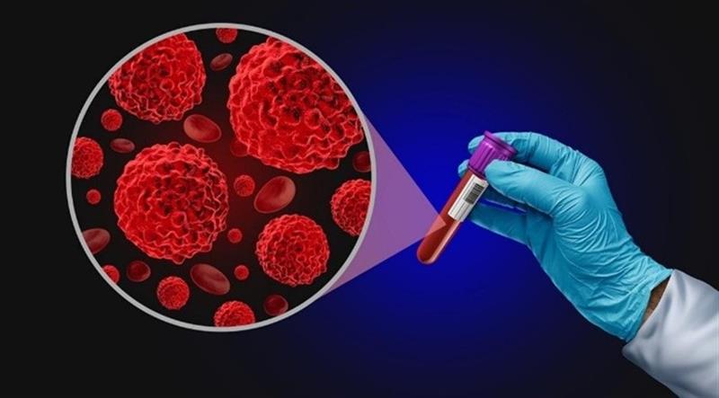 Mobarakeh Steel’s Participation in the Cancer Screening Program Earns Public Trust; A Milestone in Social Responsibility